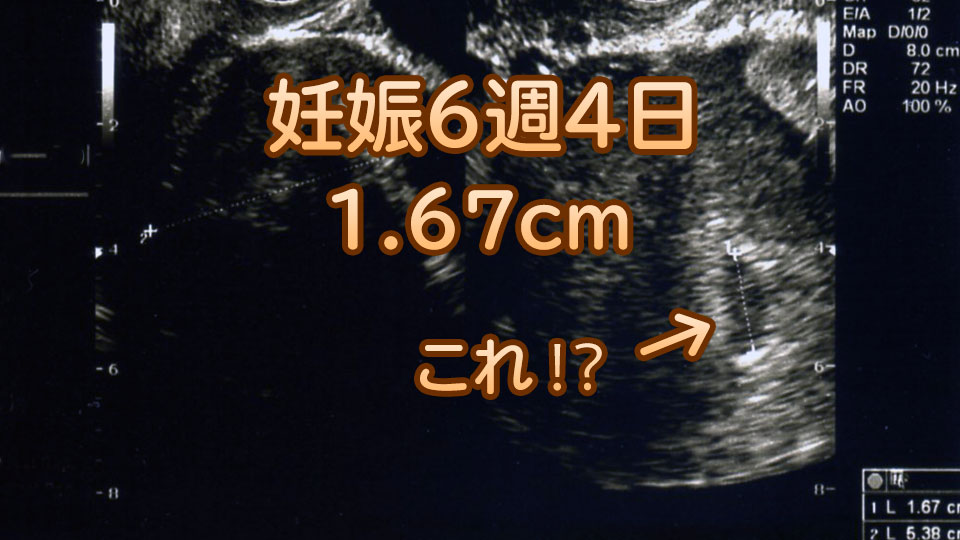 妊娠5週目から6週目 胎児の心拍を確認 つわりが始まり 膣カンジタが発覚 カイのパパブログ